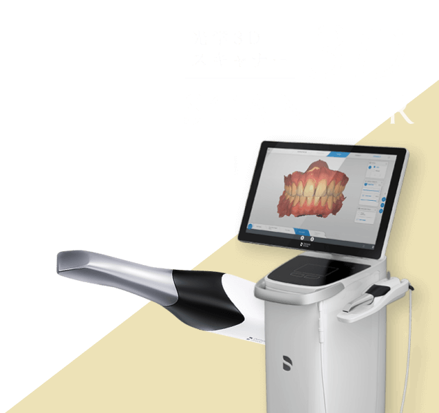 3Dスキャナー