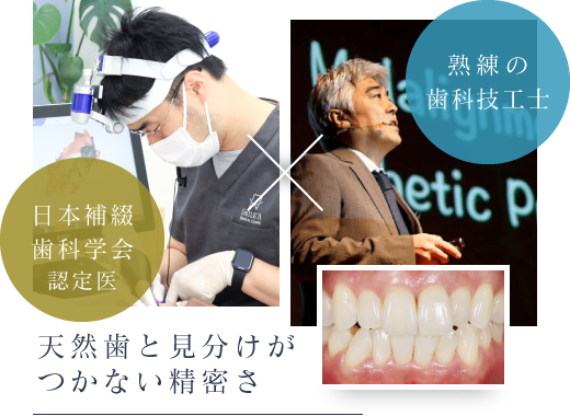 日本補綴歯科学会認定医 熟練の歯科技工士 天然歯と見分けがつかない精密さ